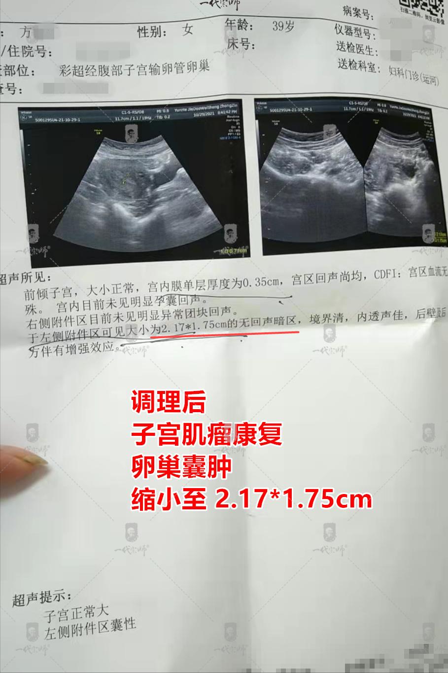 体内淤血中医辨证,去除体内淤血的名方