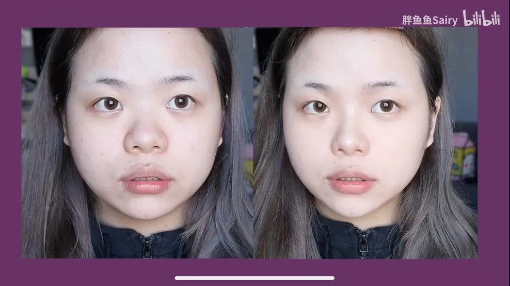 塌鼻梁低三根如何变成高鼻梁,鼻梁低怎么弄才好看