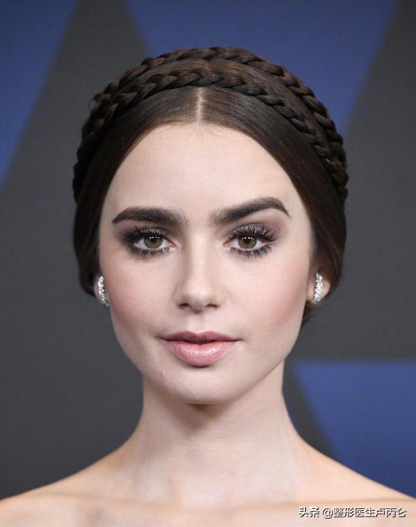 打肉毒素后多长时间可以做提眉,打完肉毒素眉毛下垂如何修复