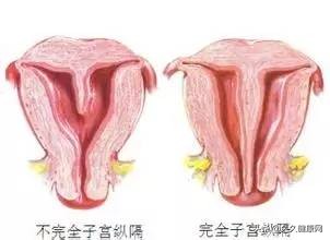 总是怀不上孕是为什么,总是怀不上二胎是什么原因
