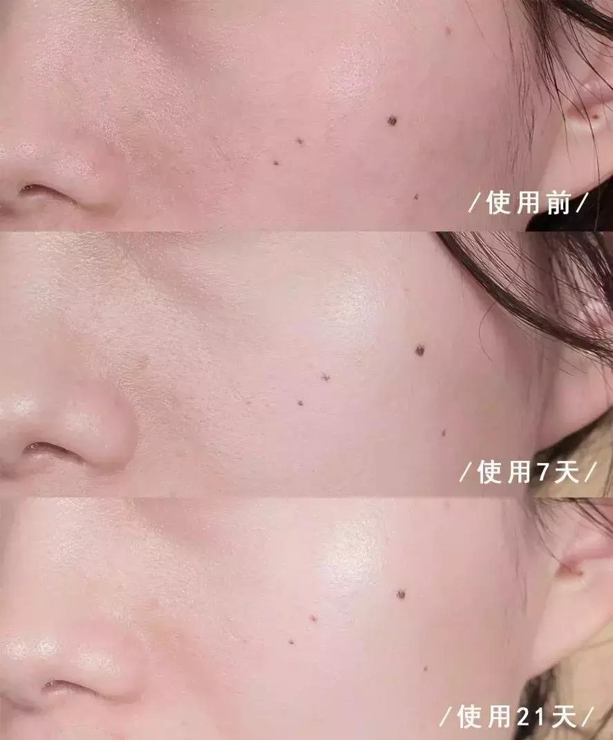 韩国小灯泡美白精华怎么样,韩国小灯泡精华真的能变白吗