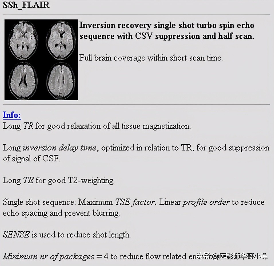 「MRI技术」磁共振伪影分析,了解下SSh_FLAIR序列