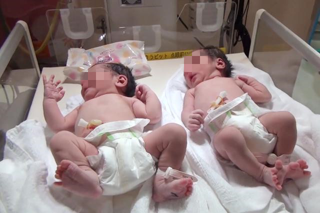 因为儿子太帅而去做亲子鉴定,孩子太帅做五次亲子鉴定