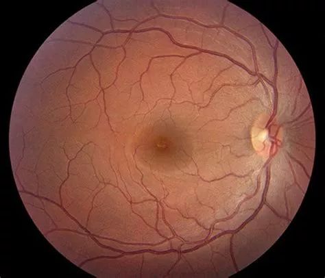 预防近视要多吃富含叶黄素的食物,蓝莓叶黄素能预防近视吗