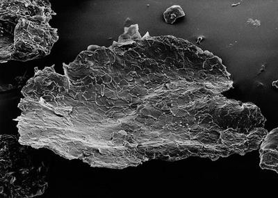 头皮屑是怎么产生的该怎么消除,头皮屑为什么多有什么办法解决