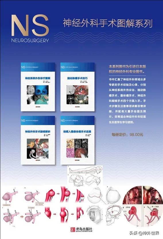 日本经验：脑外伤监测之颅内压监测