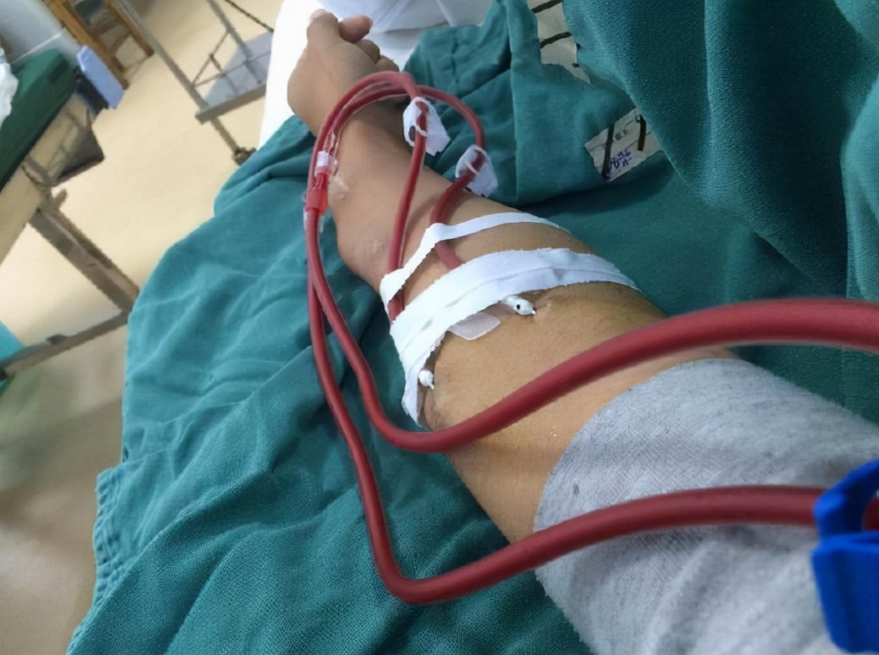 在a型b型ab型o型中哪种血型最常见,a型b型ab型o型哪种血型体质最好