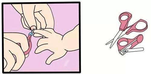 婴儿湿疹反复妈妈要忌口吗,宝宝湿疹反反复复怎么根除