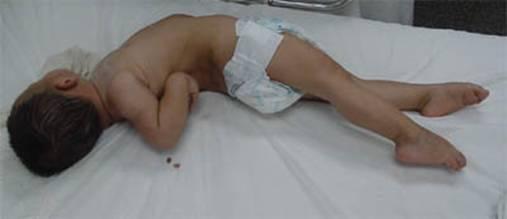 人类破伤风,人类怕破伤风吗