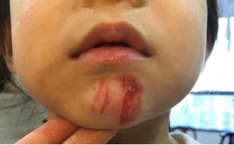 啊啊啊啊啊啊啊流血了怎么办！