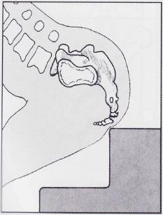 徐姑姑骨折完整版,徐姑姑骨折在第几集