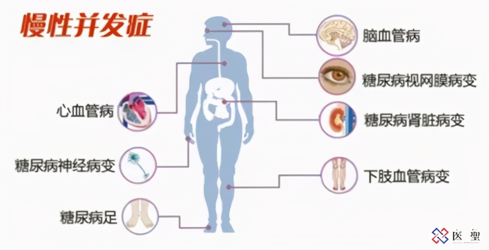 唑来膦酸钠治疗骨质疏松指征,阿仑膦酸钠是抗骨质疏松药吗