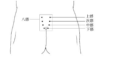 霉菌性妇科炎艾灸哪里,有艾灸治好霉菌性阴炎的案例吗