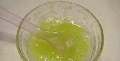 早上起来被自己眼睛吓到,眼周围的脂肪粒会自己消除