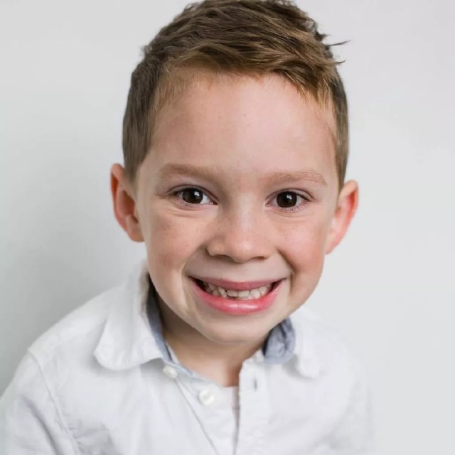 有眼纹了怎么办,30岁有眼袋眼纹很显老的感觉