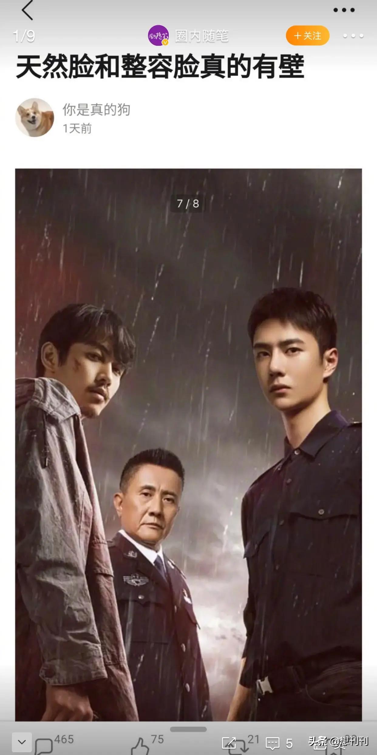 盘点一些有问题的鼻子,明星都没整好的鼻子