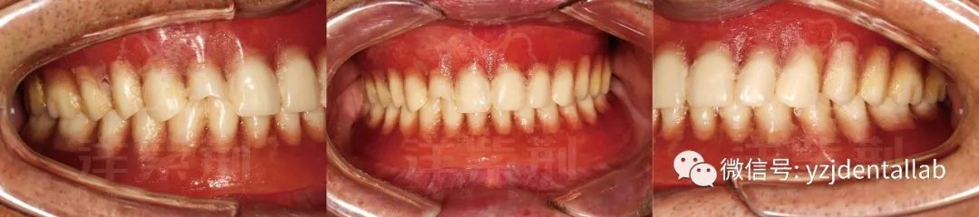 病例教学视频,病例分析操作技能