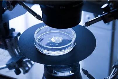 做试管婴儿之前，需要做哪些准备？这里有一份详细攻略