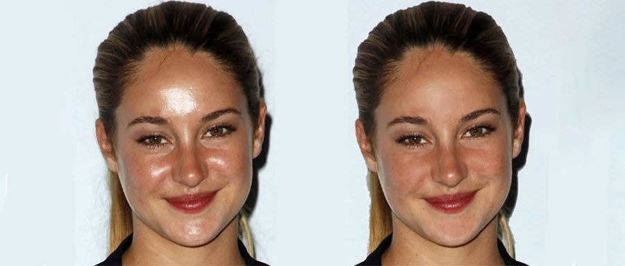 皮肤干却容易出油是干皮还是油皮,皮肤有油皮怎么办小妙招