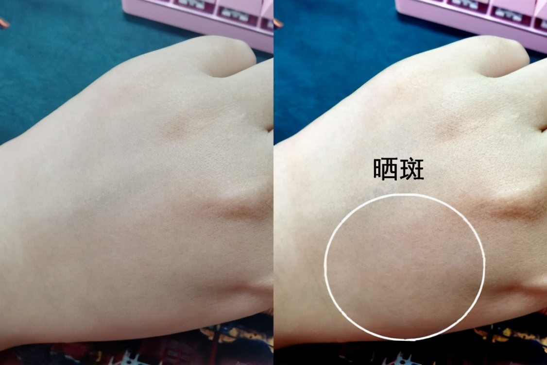 女人脸上有斑吃什么药可以祛斑,脸上长斑吃什么中药调理祛斑