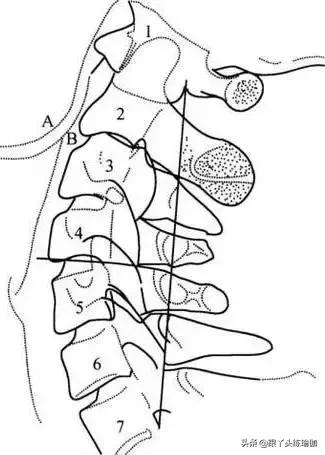 初学瑜伽颈椎基本动作视频,颈椎瑜伽初学入门视频教程