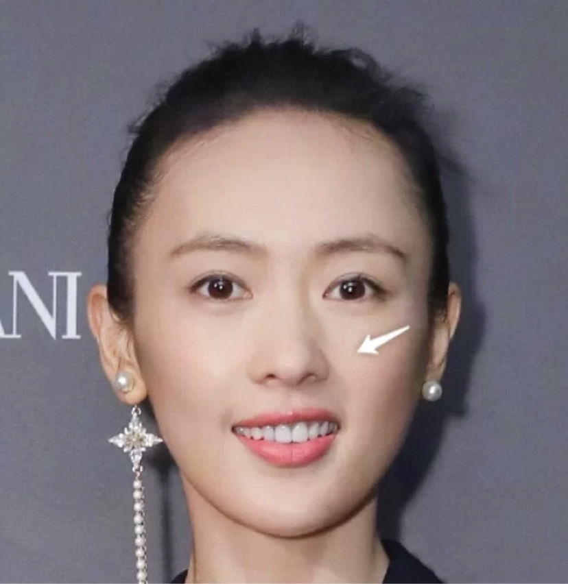 大小脸影响大吗,大小脸能不能改善