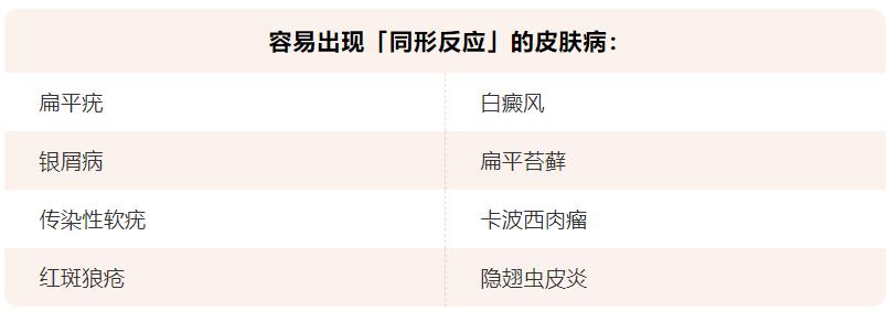 皮肤瘙痒大家有什么好的偏方吗,皮肤瘙痒别不当回事