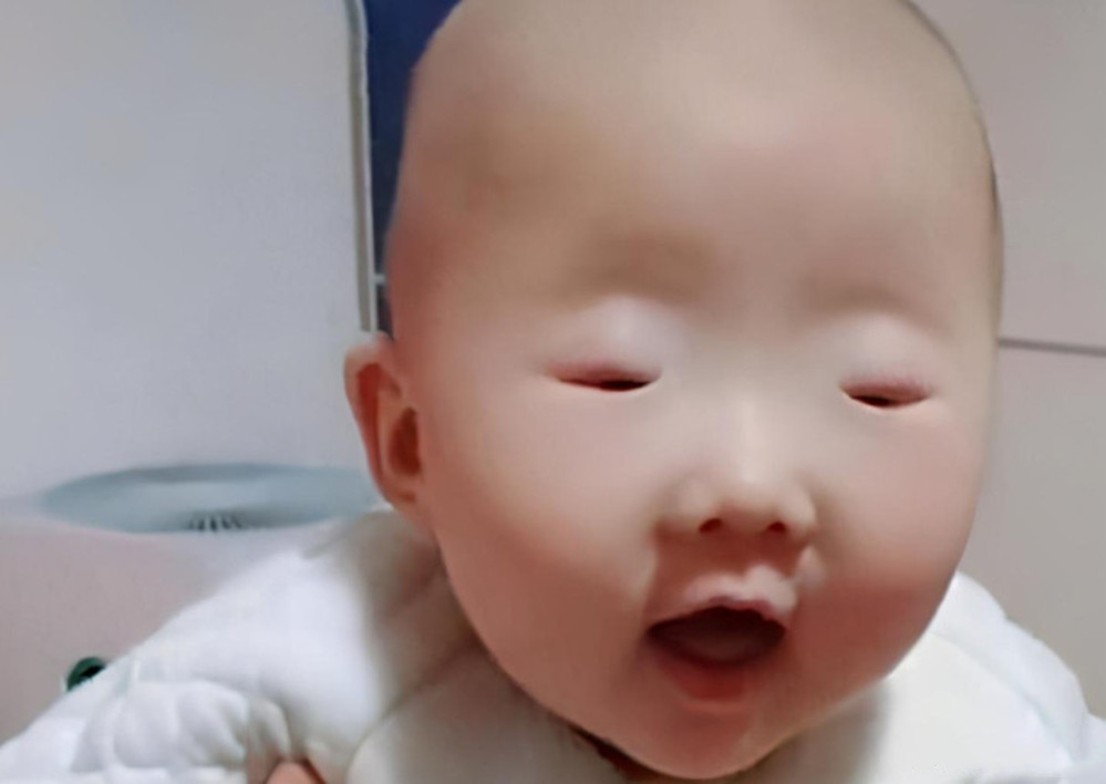 30天宝宝豆豆眼是什么原因造成的,宝宝长痘痘和妈妈饮食有关吗