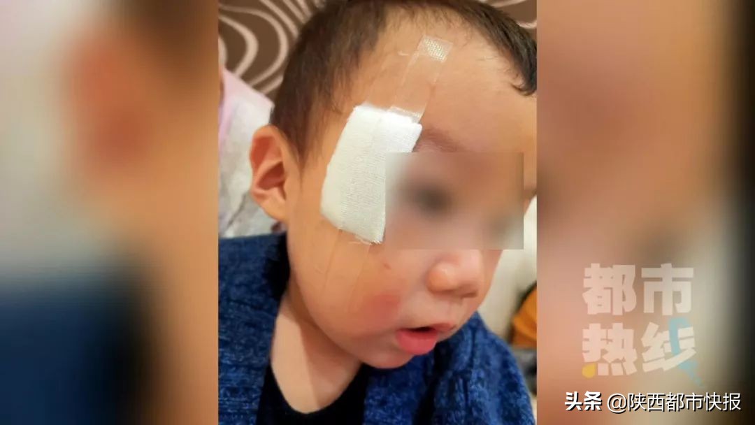 8岁小男孩眼睛被戳伤,3岁孩子游乐场被砸伤