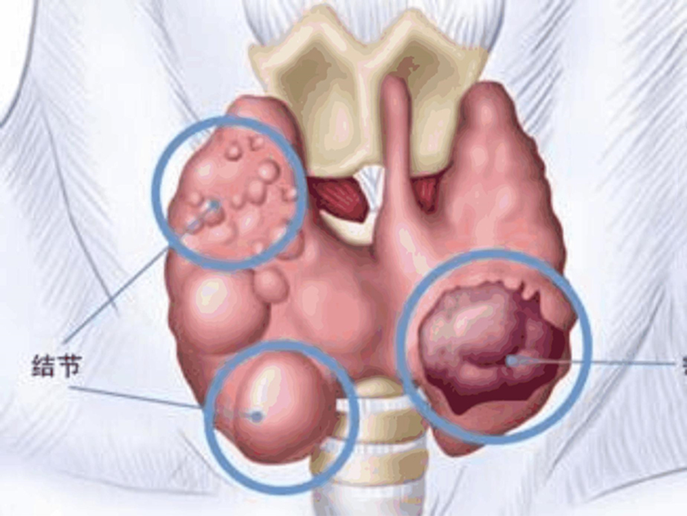 很多病其实并不是病,有些病其实不算病就是老了