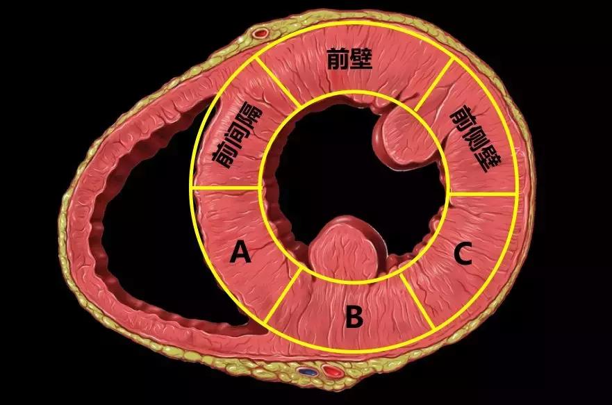 心电图和心脏彩超以哪个为准,心电图和心脏超声是一样吗