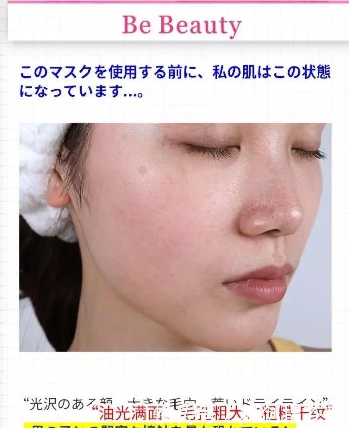 火到国外的国货痔疮膏,良心国货痔疮膏