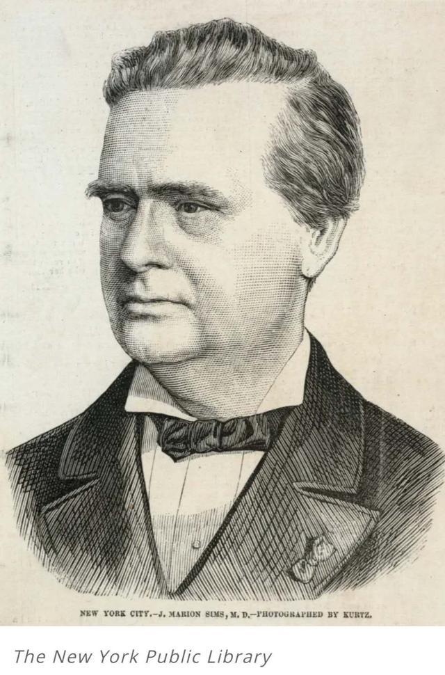 把黑人*奴女**当小白鼠练习手术，美国“现代妇科之父”雕像终被*翻推**