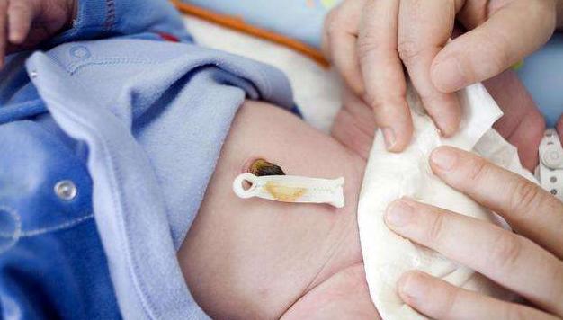 新生儿脐带护理正确的方法,新生儿脐带护理有哪些注意事项