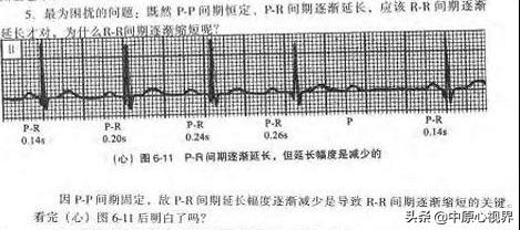 ii度ii型房室传导阻滞需要用药吗,二度文氏型房室传导阻滞严重吗