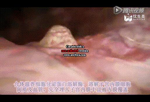 移植后神秘的14天,胚胎会发生哪些变化