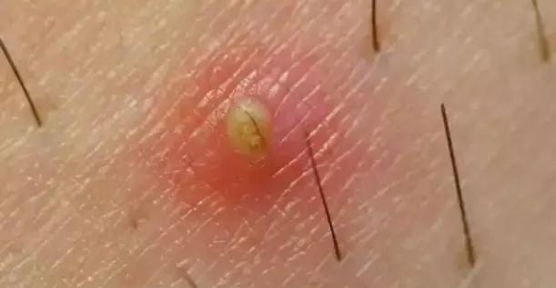 不做猕猴桃女孩是什么意思,不做猕猴桃女孩的图片