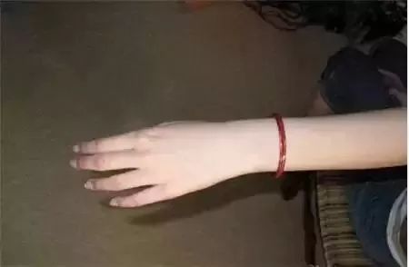 手镯长胖了脱不下来怎么办,长胖了手镯取不下来可以敲碎吗