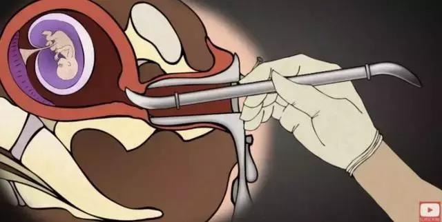 丁嘉丽明星的故事,丁嘉丽央视