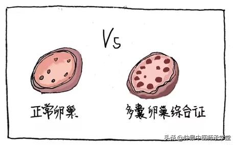 中医治多囊最好的方子,中医治疗多囊用西药吗