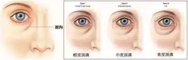 鏈変簡婊ら暅鍐嶅ぇ鐨勭溂琚嬮兘涓嶆槸浜嬪効,鍏眰婊ら暅