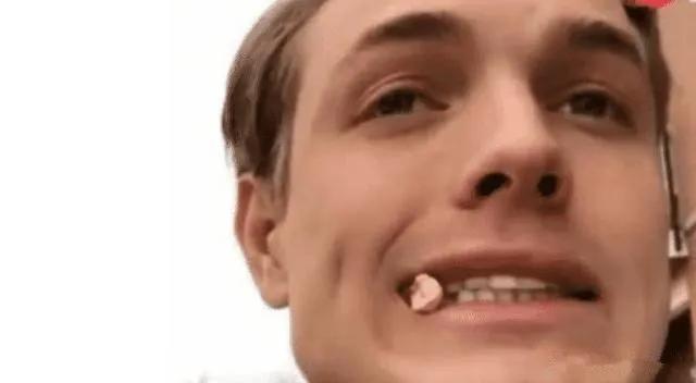 刘亦菲发腮什么意思,发腮的原因找到了