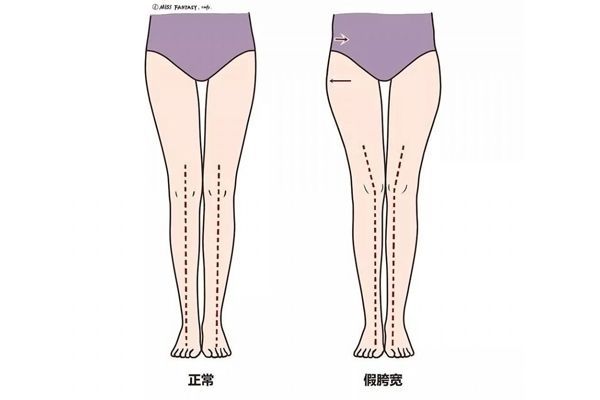 瑜伽改善假胯宽最有效的方法,假胯宽真的不好看吗