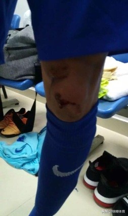 球场暴力事件完整版,球场暴力事件怎么处理