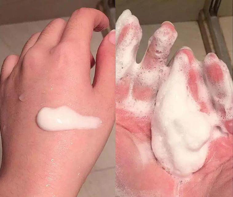 黑头可以用什么方法彻底清除,消除黑头简单有效的方法