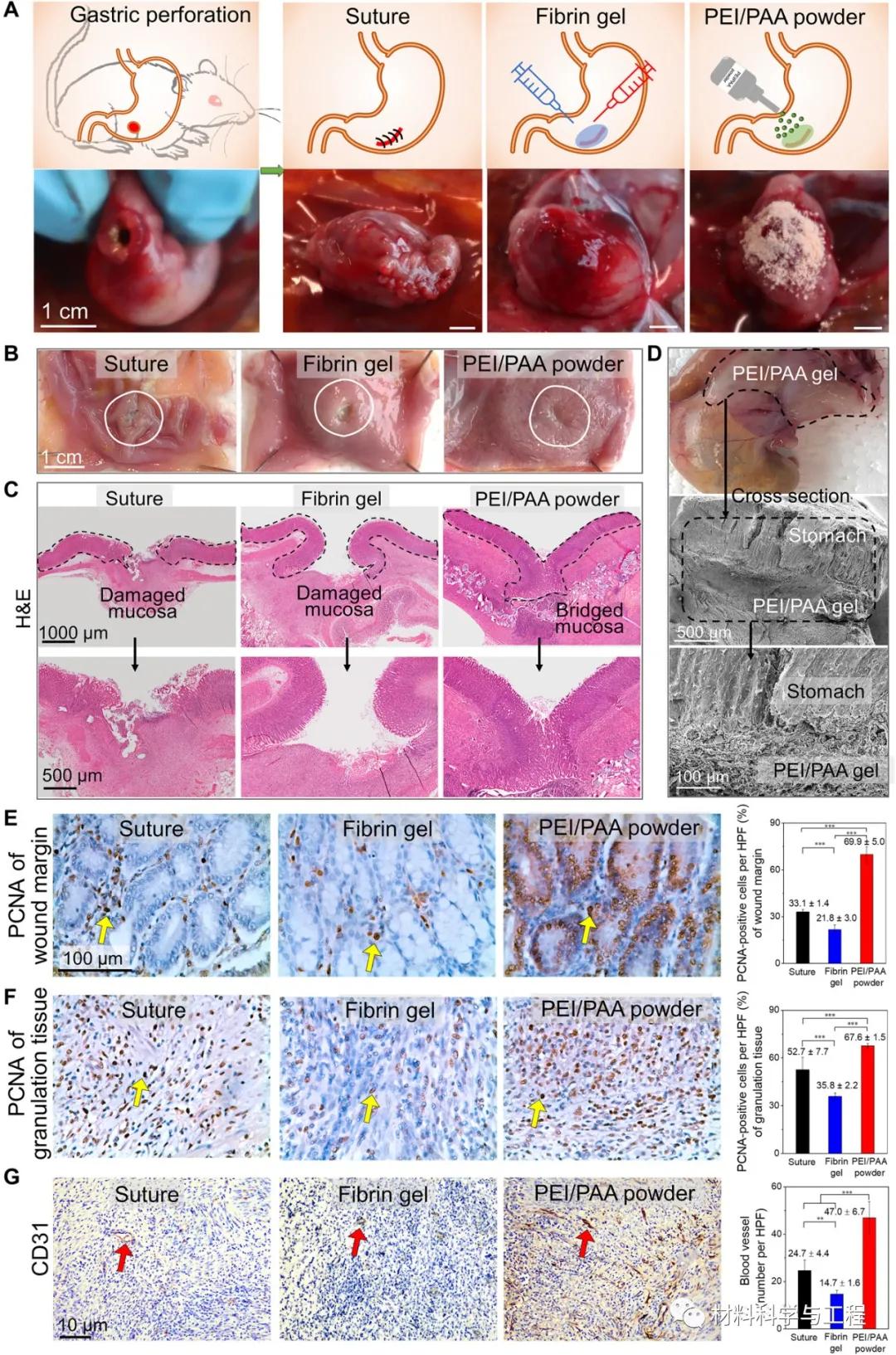 Science子刊：涂点粉，加点水，2秒就让伤口愈合、止血？