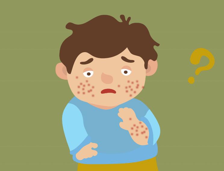 洗澡的时候搓下来的黑泥放大100倍,搓澡下来的黑泥是什么显微镜