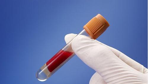 怀疑刚被乙肝传染了有补救方法吗,不小心喝了乙肝患者瓶子里的水