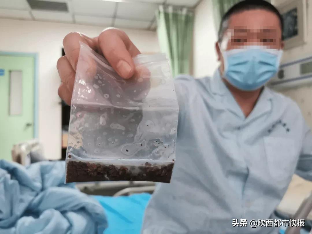 右肾萎缩左肾有结石,左肾萎缩二十几年了右肾长满结石