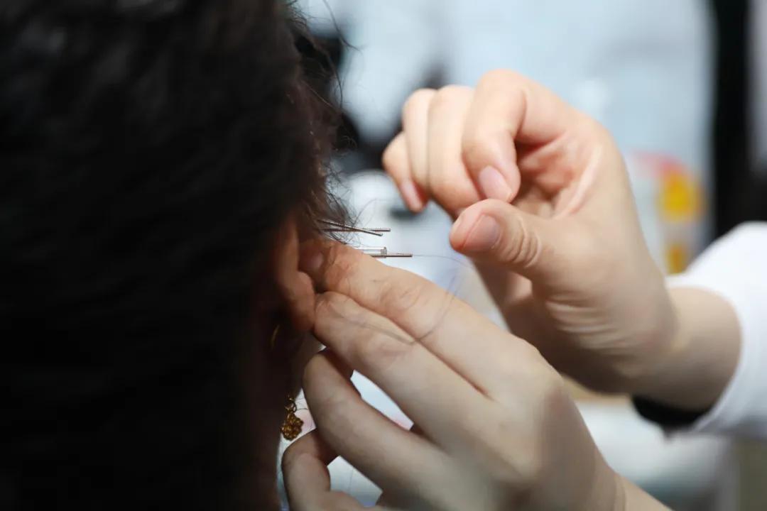 全省首推颊针疗法！长春市妇产医院麻醉疼痛门诊开诊